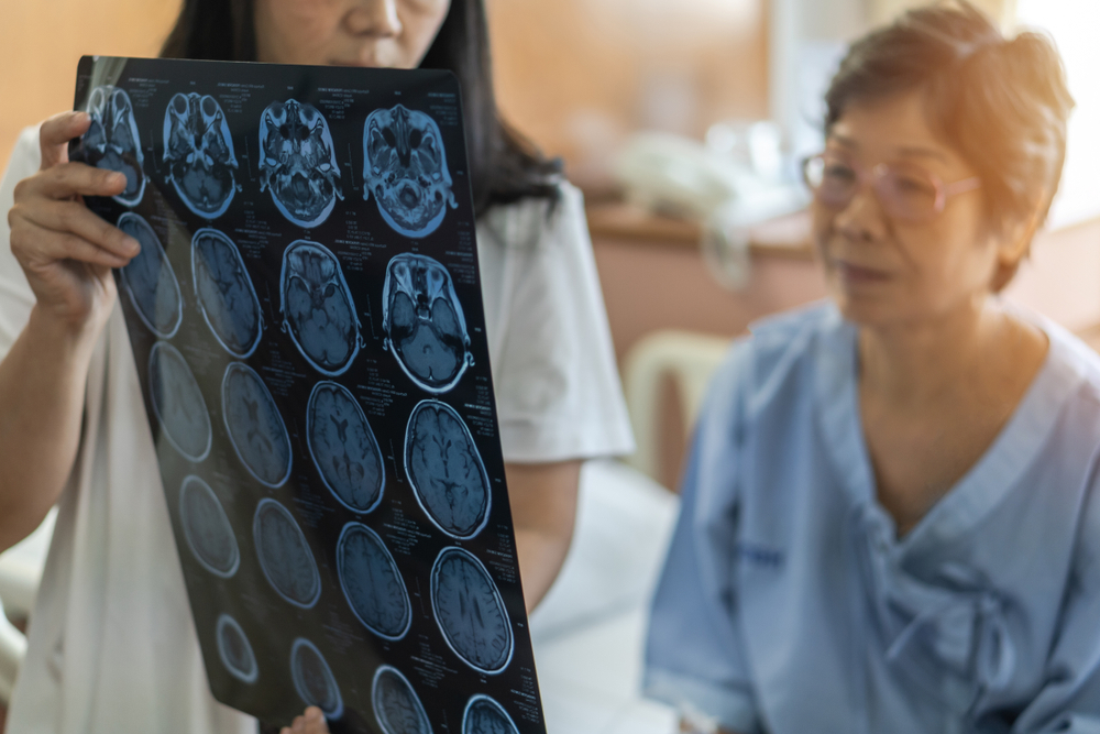Quelles sont les maladies neurodégénératives ?